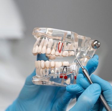 Teeth model.